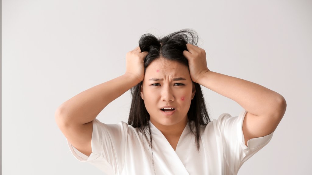 cystic acne treatment